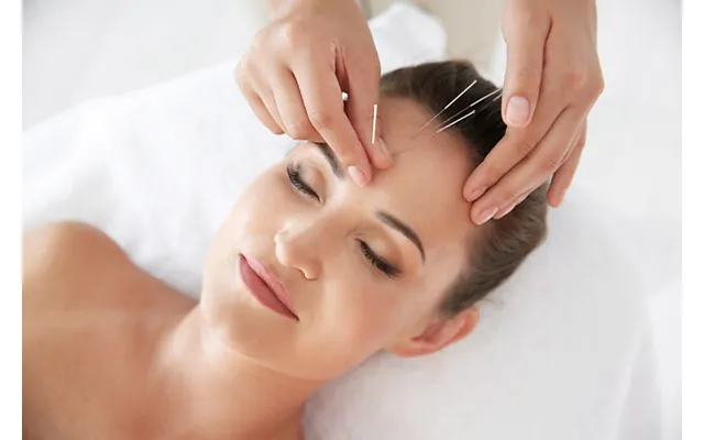 Go Dream Kosmetisk Ansigtsakupunktur Hos Clinic Chi - Frederikshavn, Oplevelsesgaver, Wellness , Gaveidé