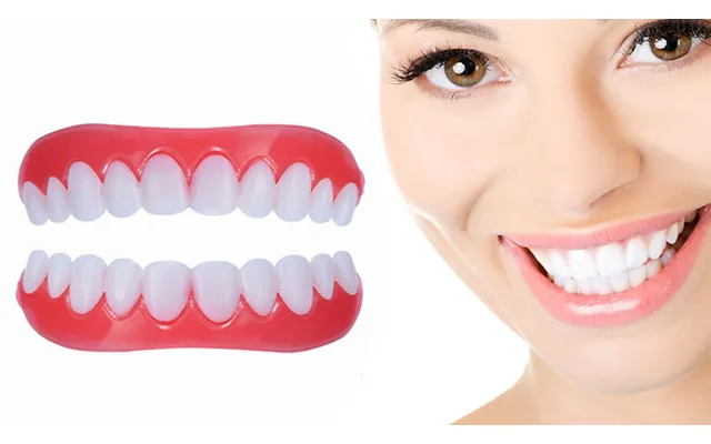 Snap-on Smile Veneers