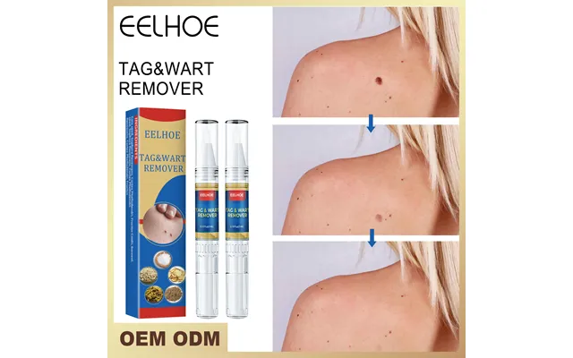 Eelhoe Ke You Liquid - Body Skin Sharp Warts product image
