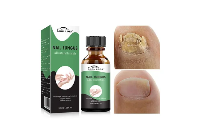 Sol Lora Repair Liquid Moisturizes Barb Brightens Oil - Soft Nail Keratin And Finger Edge Oil product image