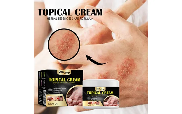 South Moon Anti-itch Cream For Hands And Feet - Skin Dry product image