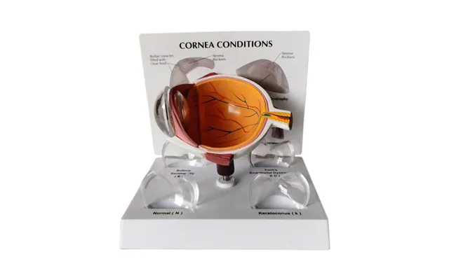 Human Eye Anatomy Model Pvc Cornea Conditions For Medical Education For Schools And Hospitals