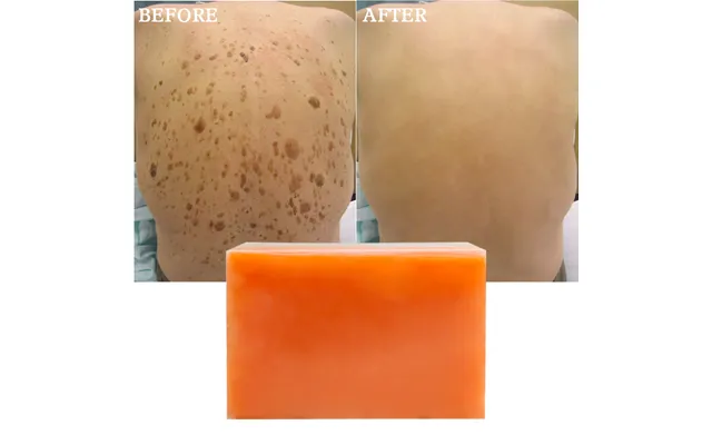 Private Label Natural Organic Skin Care Soap Bar For Dark Spots Whitening Kojic Acid Soap For All Skin Types