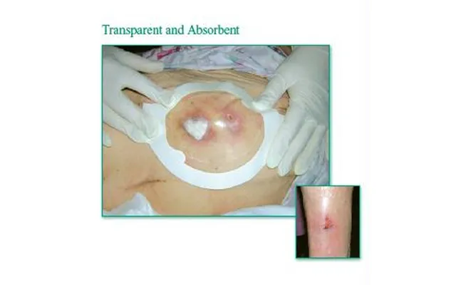 3m Tegaderm Clear Absorbent Acrylic Dressing - Small 3 X 3-3 4 Oval