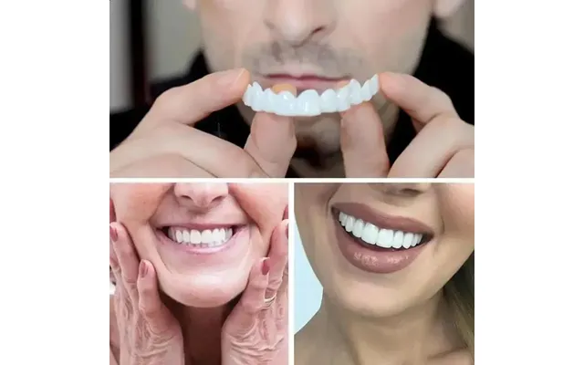 Adult Adjustable Dentures Teeth Set Snapon Portable Braces Decorate Gaps For Enhance Aesthetic 240731