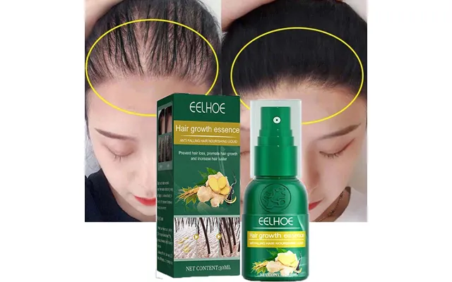 Ginger Hair Growth Spray Products Natural Anti Hair Loss Serum Prevent Baldness Treatment Fast Grows Nourish Damaged Hai