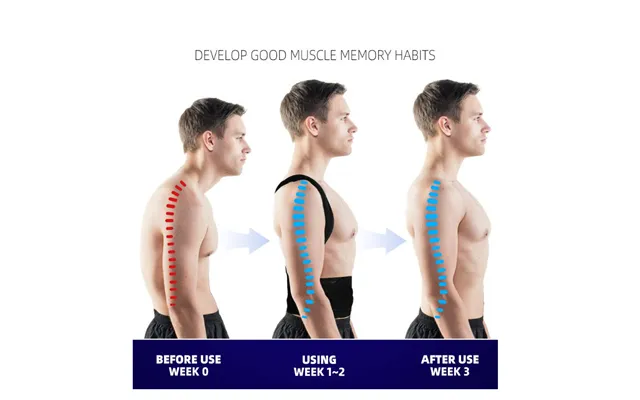 Sandwich Steel Plate Hunchback Posture Correction Strap - Back Corrector